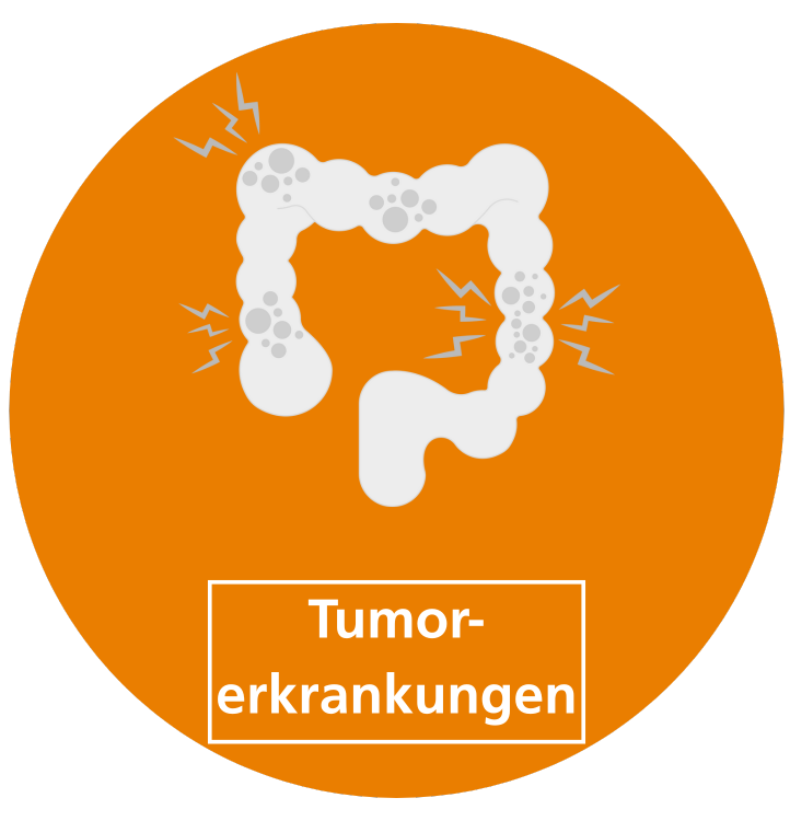 Icon Tumorerkrankungen