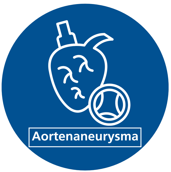 Icon Aortenaneurysma